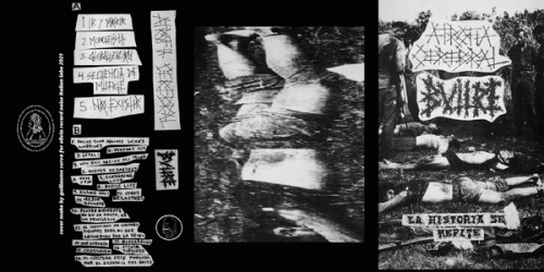 Atrofia Cerebral : Atrofia Cerebral - Buitre